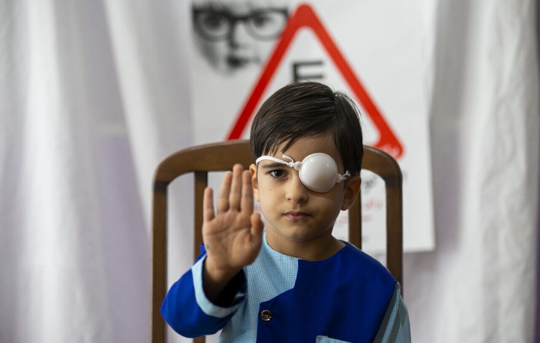 ۲۹ درصد کودکان دشتستانی تحت پوشش غربالگری چشم قرار گرفتند